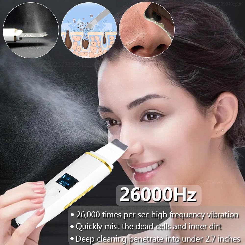 Ultrasonic Skin Scrubber Remover Blackhead Ultrasonic Peeling - Varitique